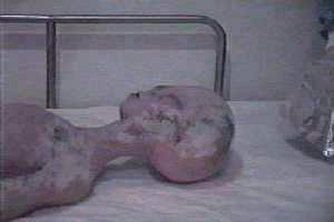 dead alien