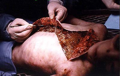 alien autopsy